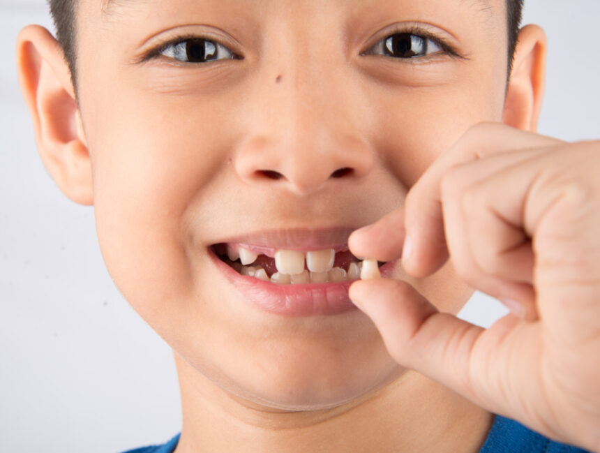 What Every Parent Needs to Know About Kids Losing Teeth
