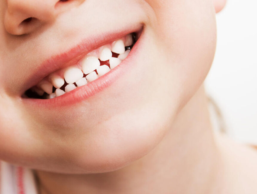 Good 9 Tips To Keep Kids Teeth Healthy