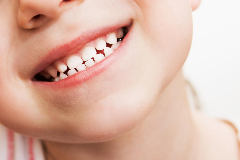 Good 9 Tips To Keep Kids Teeth Healthy