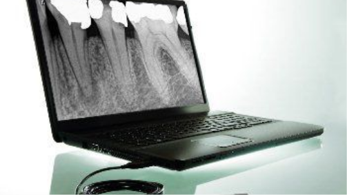 Single Tooth X-Ray